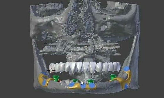 Photo Gallery - Galaxy Dental Clinic