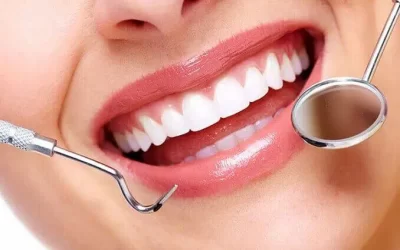 Is Professional Teeth Whitening Better Than Home Kits?