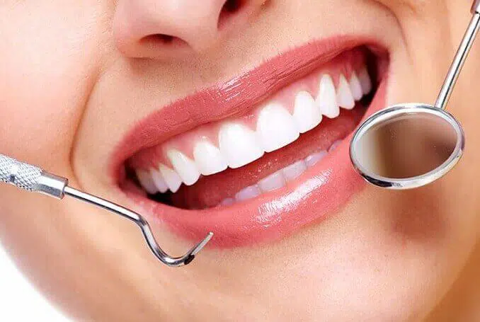 Is Professional Teeth Whitening Better Than Home Kits?