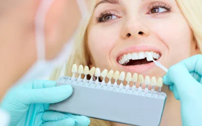 Why Choose Professional Teeth Whitening Over Home Treatments