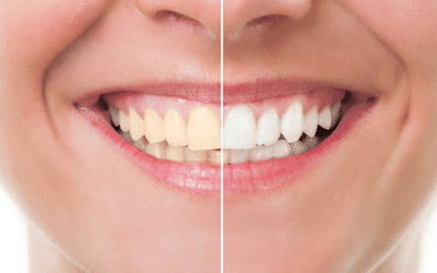 Cosmetic Dentistry: Enhancing Your Smile with the Help of a Dentist