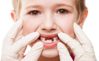 How To Manage and Prevent Tooth Decay in Toddlers