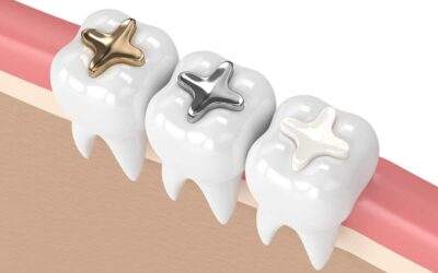 Types of Dental Fillings: Which One Is Right for You?