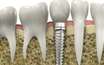Root Canal Treatment in Rahatni: Is It Painful? Myths vs. Facts