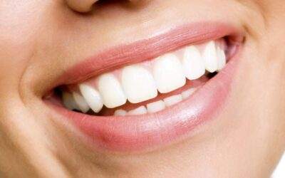 What Are The Most Effective Home Remedies For Whitening Teeth?