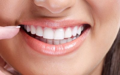 “Top 5 Cosmetic Dental Procedures Popular Among NRIs Visiting Pune”