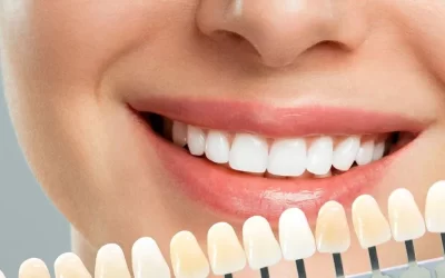Smile Makeovers in PCMC: How Cosmetic Dentistry Can Transform Your Confidence
