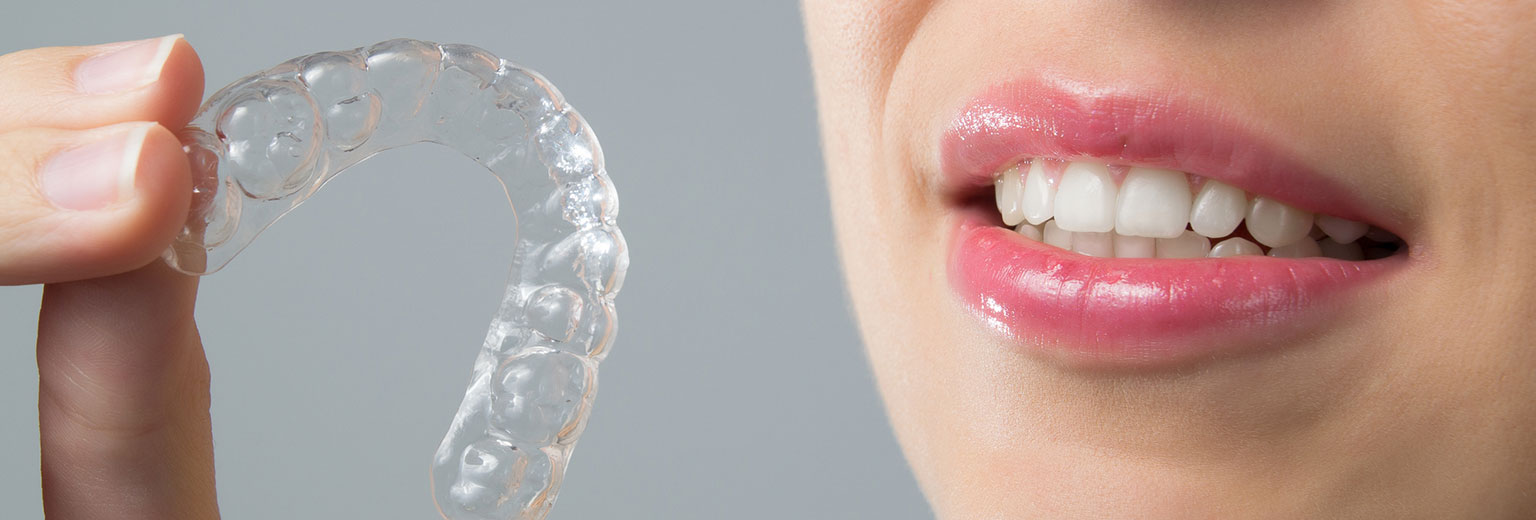 Braces for Adults in Pune – It’s Never Too Late to Straighten Your Smile!