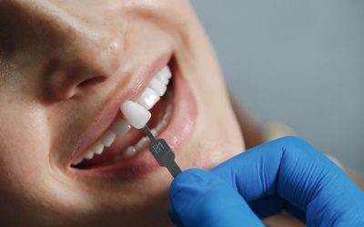 Step-by-Step: What to Expect During Your First Dental Implant at Galaxy Dental Clinic