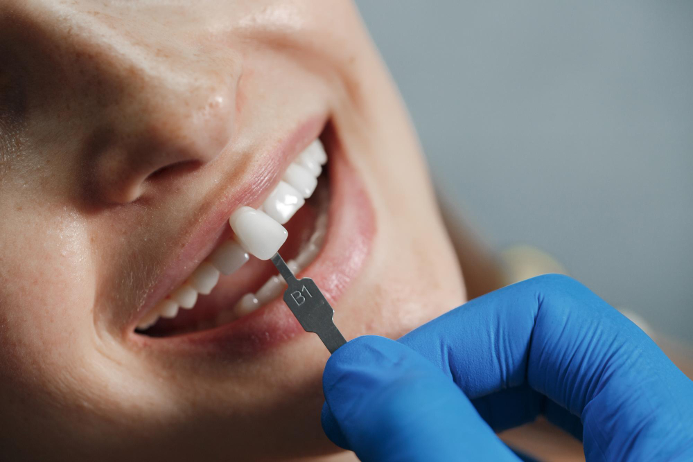 Step-by-Step: What to Expect During Your First Dental Implant at Galaxy Dental Clinic